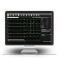 Software PC Edan Smart Viewer SE-1515.