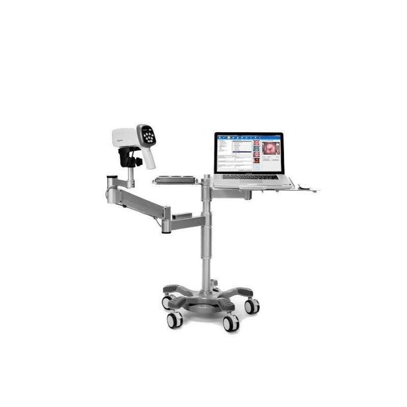 Videocolposcopio LED rodable 36x Edan C6A.