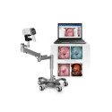 Videocolposcopio LED rodable 36x Edan C6A.