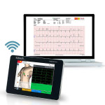 Electrocardiógrafos